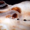 microdissection_profile_2